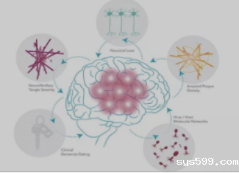 多重治疗手段探索AD治疗新路径